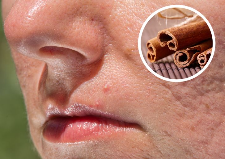 Faydaları Saymakla Bitmiyor! Yiyeceklerinize Tarçın Eklemek İçin 7 Önemli Sebep